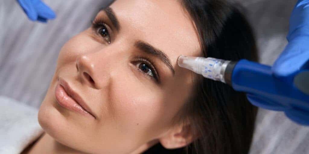 Rezenerate Facial (Nanofacial) vs Microneedling