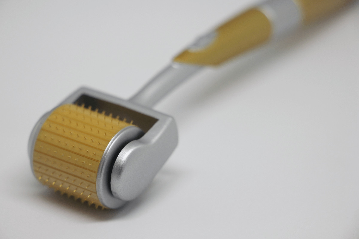 Can Microneedling Cause Acne: What You Need to Know