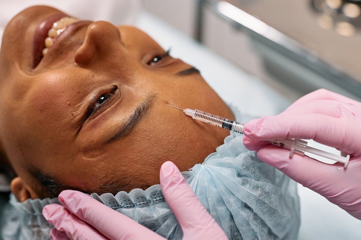 Can I get Botox after microneedling - understanding safe timing between skin rejuvenation treatments
