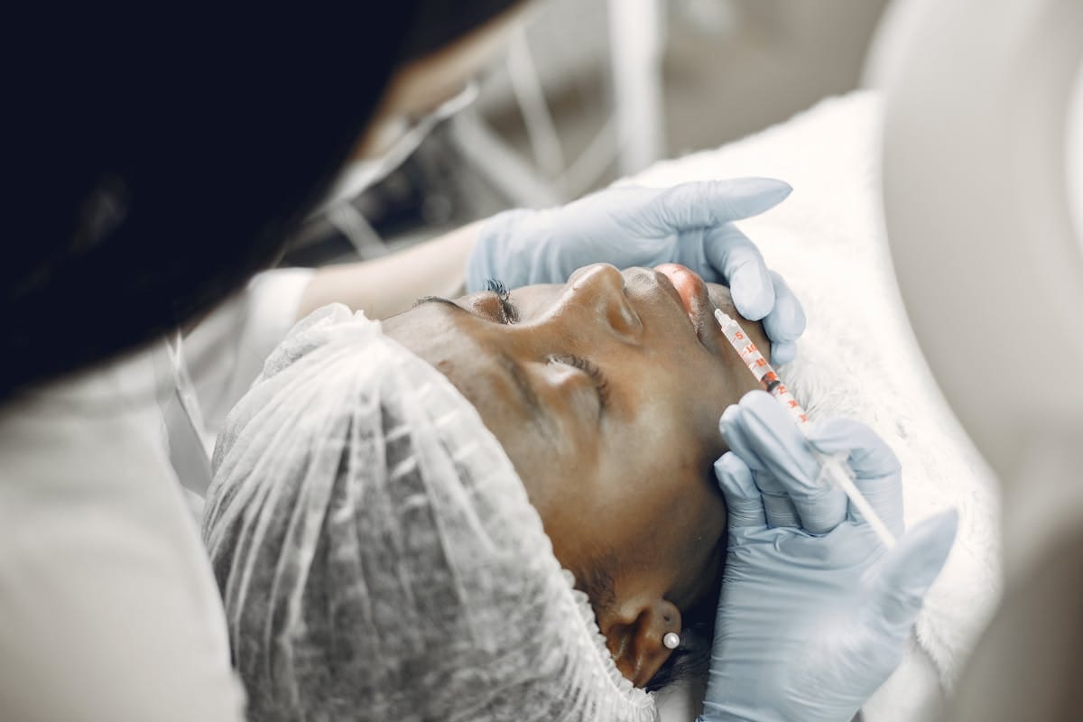 Do lip fillers hurt - numbing cream applied before lip filler injection for comfort during treatment