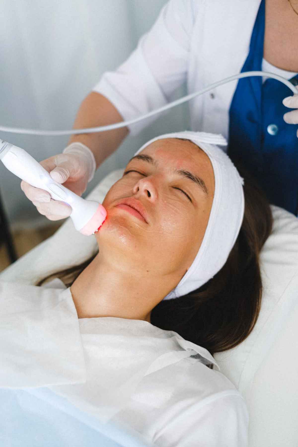 Microneedling derma roller skin treatment collagen