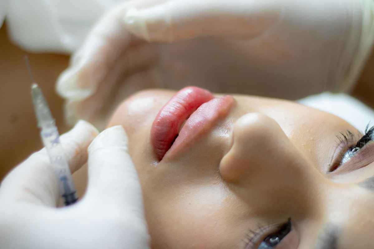 Close-up of a woman receiving a lip augmentation with a syringe by a professional.