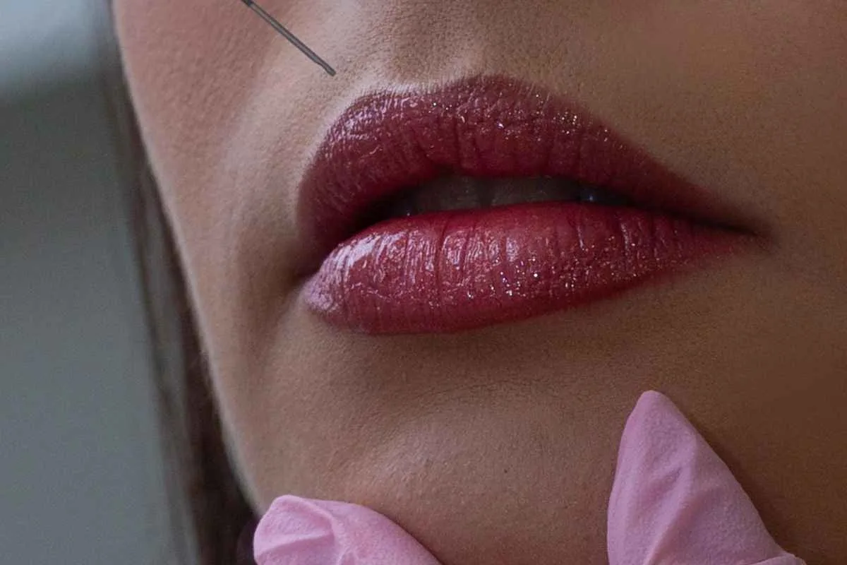 Close-up of a woman's lips receiving a cosmetic filler injection in a clinic setting.