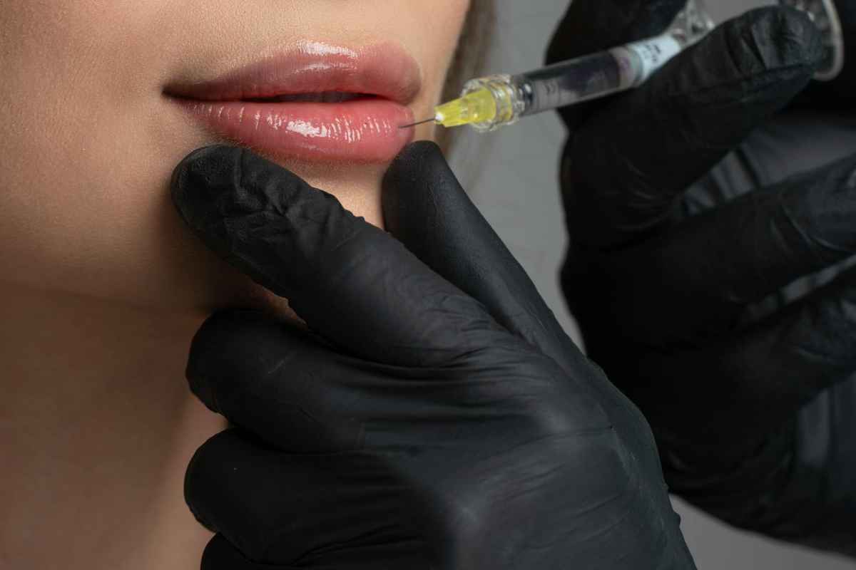 Detailed image of a cosmetic lip injection being administered by a professional.