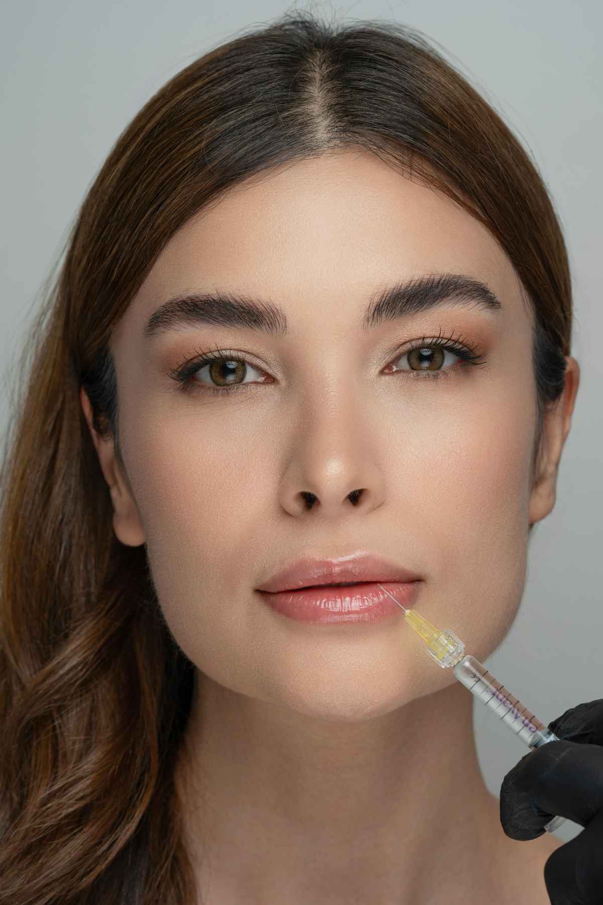 Lip filler injection procedure close up settling timeline at clinic