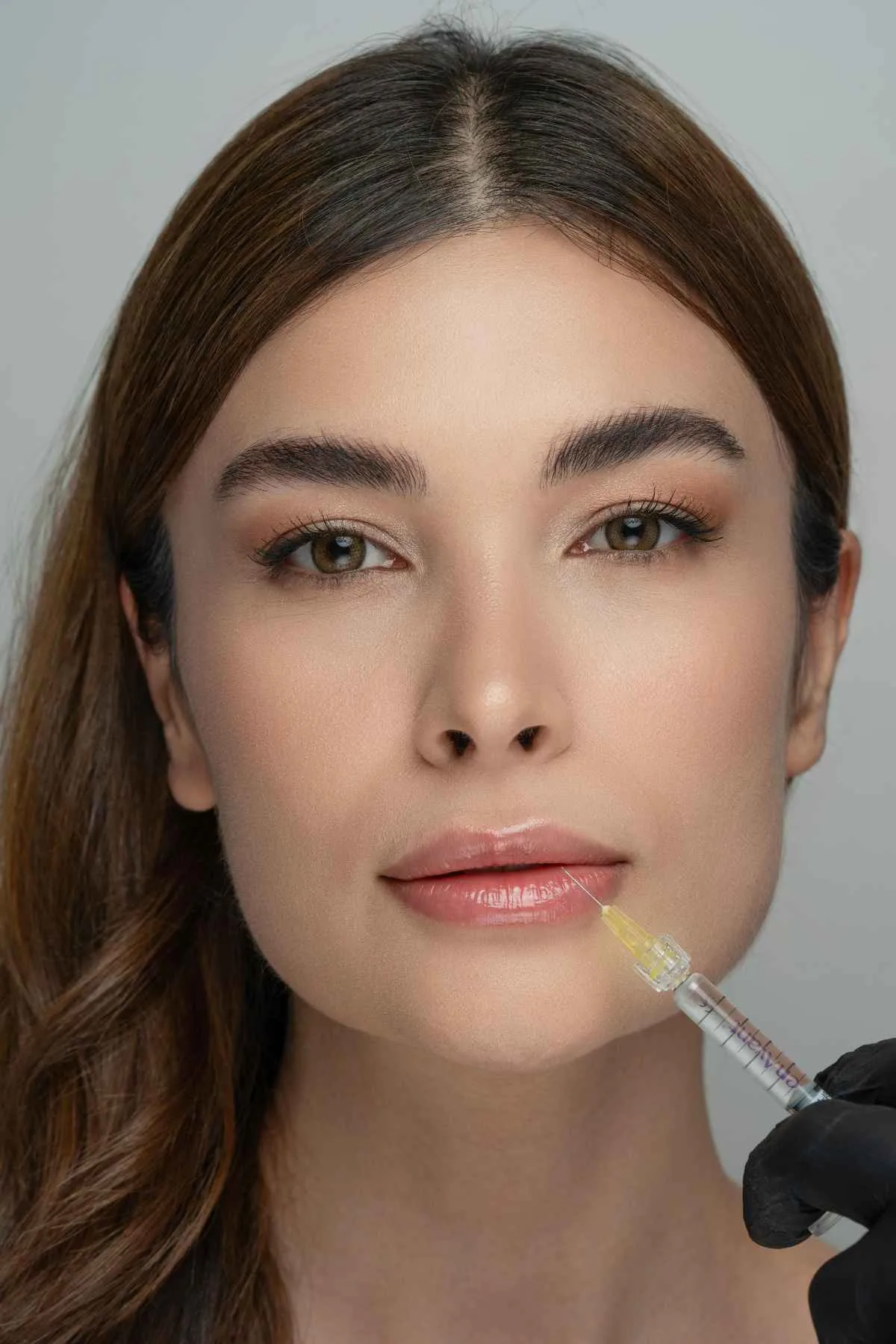 How Long Does Lip Filler Take to Settle? Essential Timeline Guide with 4 Key Stages 3 Lip filler injection procedure close up settling timeline at clinic