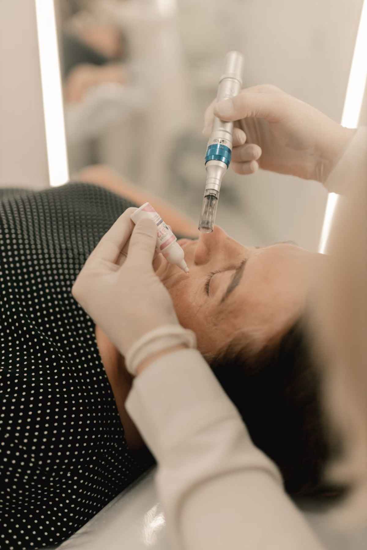 Close-up of person receiving microneedling beauty treatment in a clinic